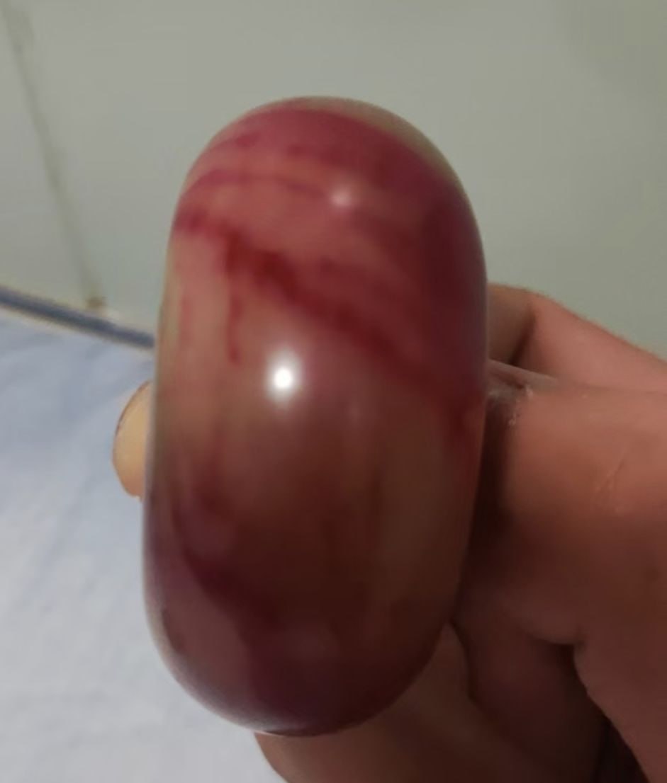红白纹玉石